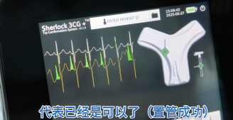 盐城首家！！首例！ 我院护理技术新发展，创新开展3CG磁导航PICC置管术！